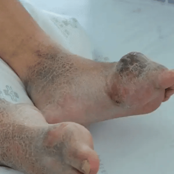 Pachete naturale pentru detoxifiere și drenaj limfatic