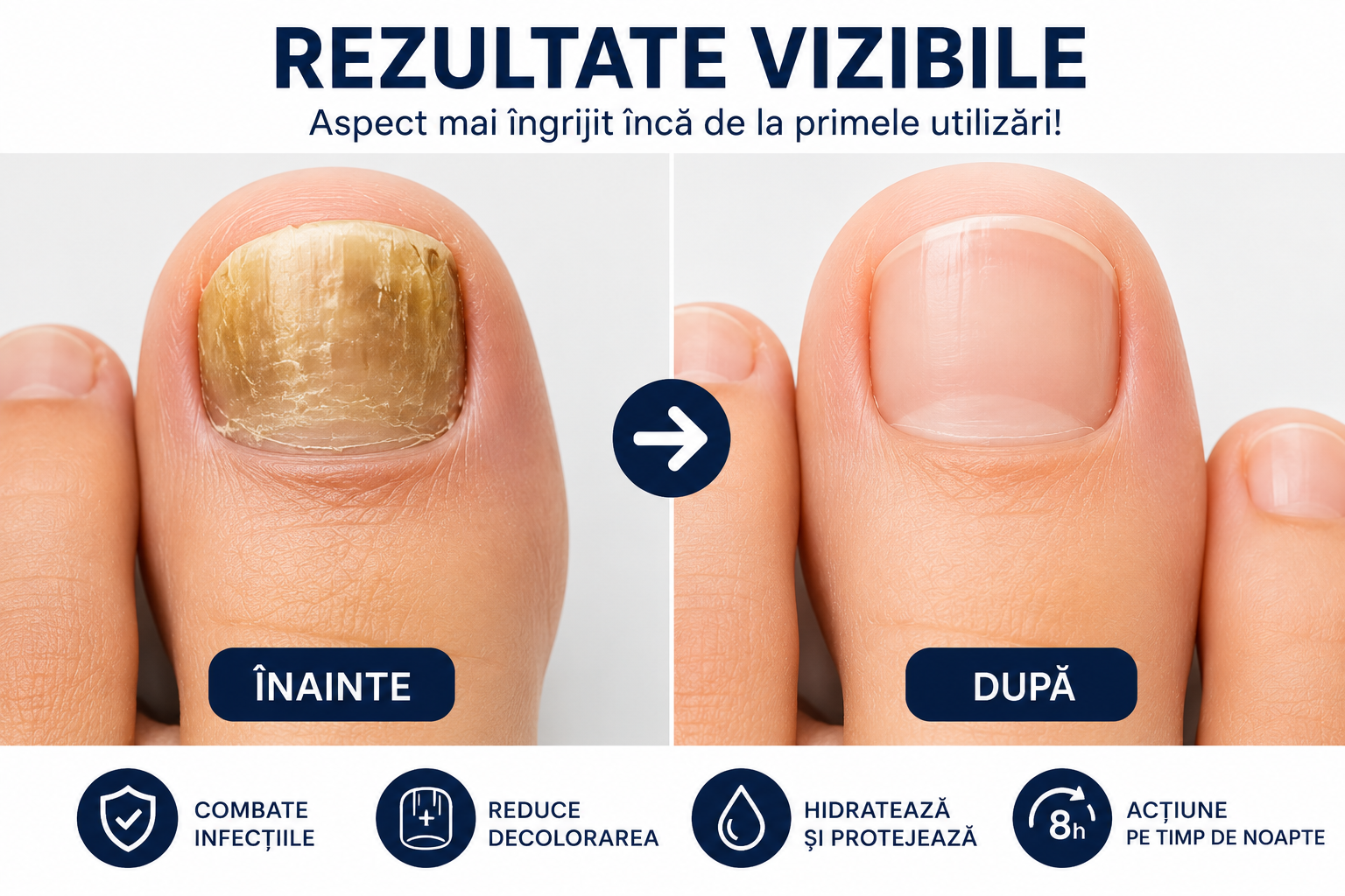 Plasturi pentru Ciuperca Unghiilor™ | Acțiune Peste Noapte